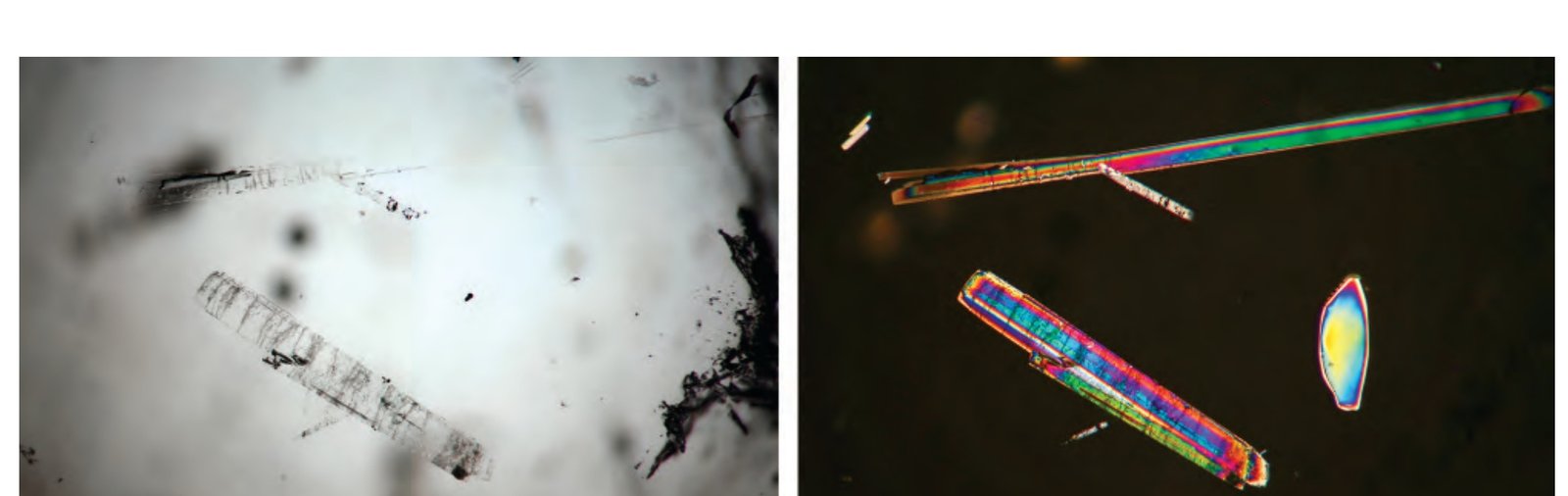 Anomalous double refraction and lattice strain in spinel